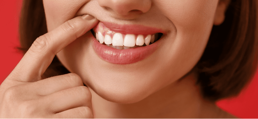 インプラントと歯茎の美容問題
