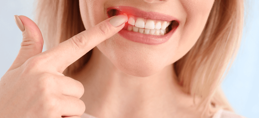 前歯インプラント治療の制約